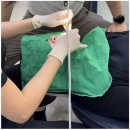 명 치과기공소 이미지