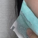 정동호콤치과의원 | 하루에 사랑니 4개 뺀 후기*관리(+매복2개, 긴글 주의,요약본참고-사랑이아프니홍대점)