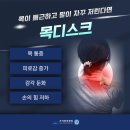 초기 목디스크 병원치료 받아야 하는 이유! 이미지