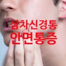 삼차신경통 병원 수원 마취통증의학과 안면통증 사례와 진단