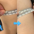 연제구-119 | 연산동피부관리 리하에스테틱 웨딩관리 팔뚝 관리 후기