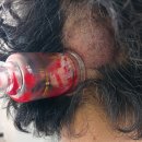 재활치료시설 | 대자인 병원이후 재활병원 거쳐 역술가의 부적으로 뇌출혈 치료한 후기