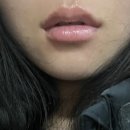 어린공주성형외과의원 이미지