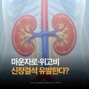 마운자로·위고비 신장결석 유발한다? 팩트체크