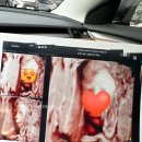 한번에 임신 됐다!! 25~26주 기록:: 연세맘스그린 입체초음파 후기(좋은점, 아쉬운점)