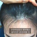헤어,어느날 이미지