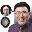 현대가발 이미지