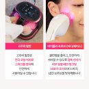 고주파 리페어 이미지