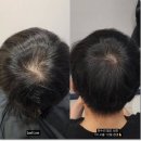 눈썹을디자인하다 이미지