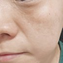 순수화장품 - 영등포구 디지털로37나길 20 | 더순수AC컨트롤로션 후기｜여드름화장품 추천, 청소년여드름화장품 여드름로션 사용기