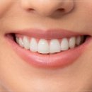 서울리마치과의원 이미지