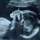 산본즉떡 | [임신 20주~21주 기록] 산본제일병원 정밀초음파 후기, 즉떡즉떡 두번째 방문