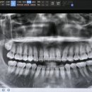 톡톡사랑니치과의원 이미지