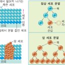 암 - 양성종양과 악성종양 이미지