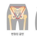 코지밸런스