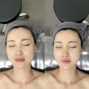 상동회관 | 부천피부관리 윤곽관리받고 얼굴작아진후기 더예쁠예정 작은얼굴 부천상동역점