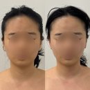 에스테틱 유] 작은얼굴 갖고싶어? 일단 모란으로 와;; 3V 테라피 후기! (모란피부관리/무통증 윤곽관리)
