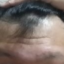 (주)유바이오메드 이미지