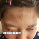 바르델