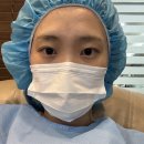 연세안경마트 | 초고교급근시의 라섹 도전기(난시근시합-12)