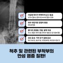 류마참내과의원, 강직성척추염 명의 진료 가능합니다! [류마티스내과 명의]