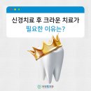 부경에스치과의원 | 칠성동치과 신경 치료 이후에 크라운 치료 왜 필요할까요
