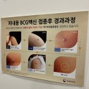 우리가정의원 | 양천 삼성탑가정의학과의원 1차 영유아검진 피내용 BCG백신 후기