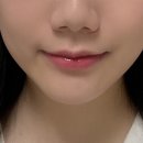 홀드의원 이미지