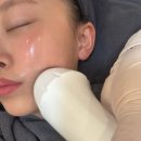 엑셀고급 | 엑셀웨이브 페이스 리프팅 이중턱개선 얼굴라인개선 선릉역 피부과 내돈내산 솔직후기