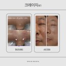 송월타올예산내포총판 | 크레이지015 정말 좋을까