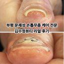 뷰티케어 리얼 | 부평 문제성 손톱무좀 케어 전문: 김수정뷰티 리얼 후기