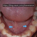 연희세브란스치과의원 이미지