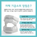 클래스치과기공소 네이버블로그