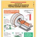 뇌·뇌혈관 MRI 검사, 뇌질환 의심 등 꼭 필요한 경우에만 건강보험 보장됩니다 이미지