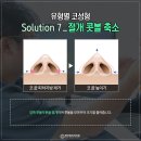 별성형외과의원 네이버블로그