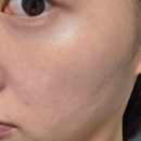 닷블레스유 | 행궁동피부관리 닷블레스유에서 멜라리티 색소관리 프로그램으로 기미&잡티 해결!