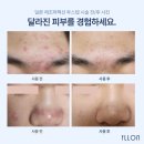 피부가꿈 이미지