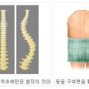 바른척추운동처방센터
