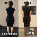 신당1로 | [구미 마운자로 -8kg 감량] 마운자로와 통합치료로 1석 2조의 효과 누리기