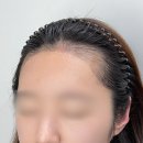 그린헤어아트 | 마곡헤어스트록 아트인디고 마곡눈썹&amp;SMP마곡점 본식 전 신부 헤어라인 문신 후기