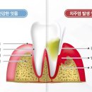 단계뿌리깊은치과 네이버블로그