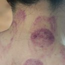 어담한의원 이미지