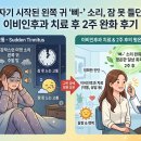소리이비인후과 | 주말 밤 갑자기 시작된 왼쪽 귀 '삐-' 소리, 잠 못 들던 이명 증상 이비인후과 치료 후 2주 완화 후기