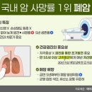 “ 폐암(肺癌) 위험 치솟는다”… 의사가 꼽은 ‘흔히 저지르는 실수’ 3가지 이미지