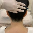 아나덴슈가링왁싱 대구상인점 | [결혼]웨딩촬영 왁싱제모 대구상인월배진천 "오아왁싱슈가링" 내돈내산 후기