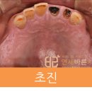 연세바른치과 이미지