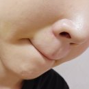 (주)케이바이오팜스 | 레티날 크림 0.1% 퓨어케이 LNP기술 팔자주름 한달 후기