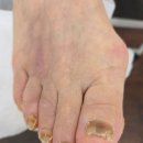 레푸스남양주블루밍네일 | [경기도 남양주] 진접네일샵 더네일 앤 레푸스 진접점에서 발톱 힐링받은 후기!!