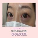 라이트파마 | 첨단 속눈썹파마 자연컬 끝판왕 아이라이트