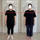야무진허리상담소(목어깨허리무릎체형교정) | 대구 동성로 체형교정 몇 년째 반복되던 허리 통증, 운동으로 완화된 실제 후기